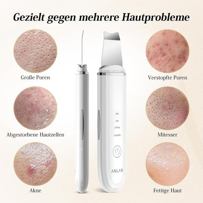 Nettoyeur de Peau Ultrasonique - heuremarket