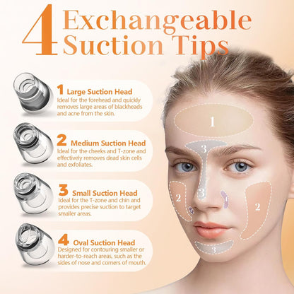 Aspirateur de Points Noirs Professionnel - heuremarket